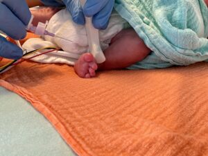 Ultraschallgesteuerte Venenpunktion am Patientenbett